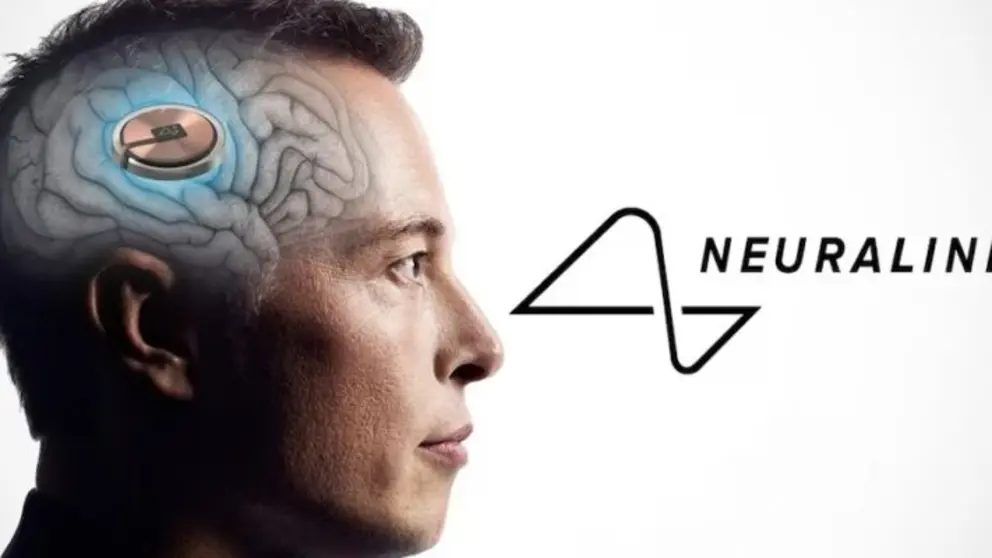Neuralink