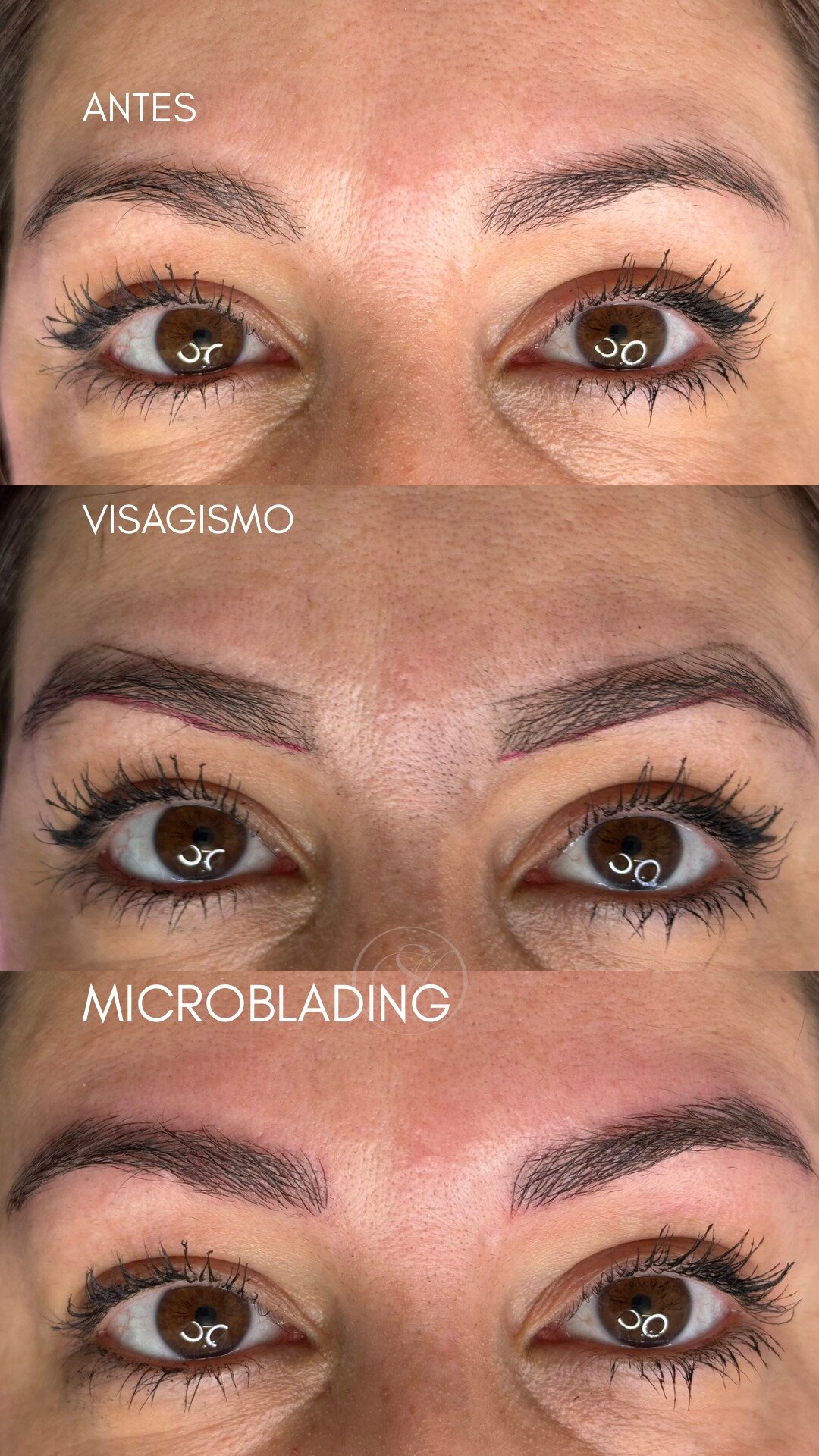 Micropigmentación